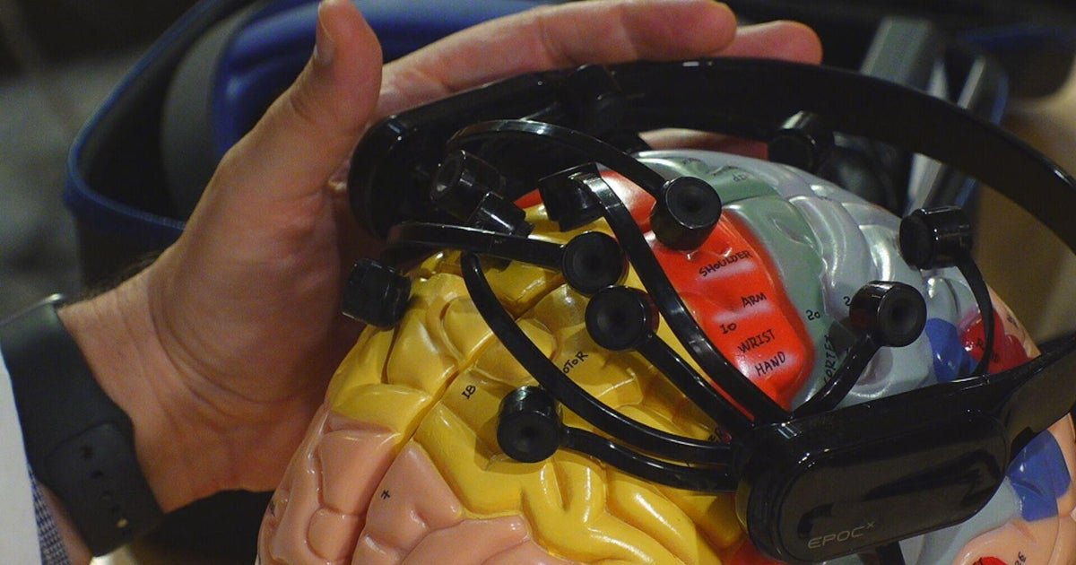 What's the age of your brain? Neurotechnology study by Colorado doctor has the answer.