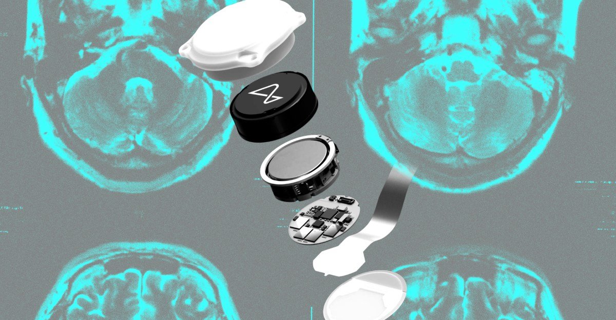 Did Neuralink make the wrong bet?