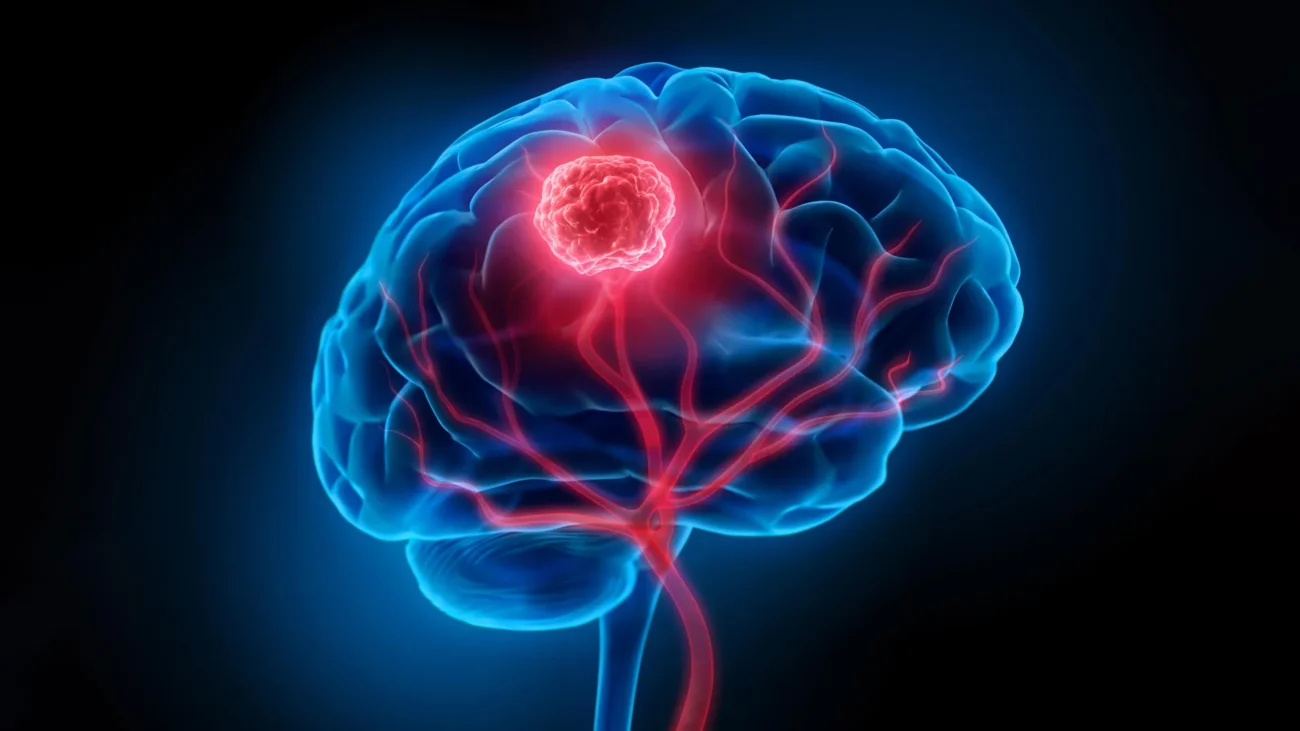 Scientists find hidden brain cells helping deadly cancer grow