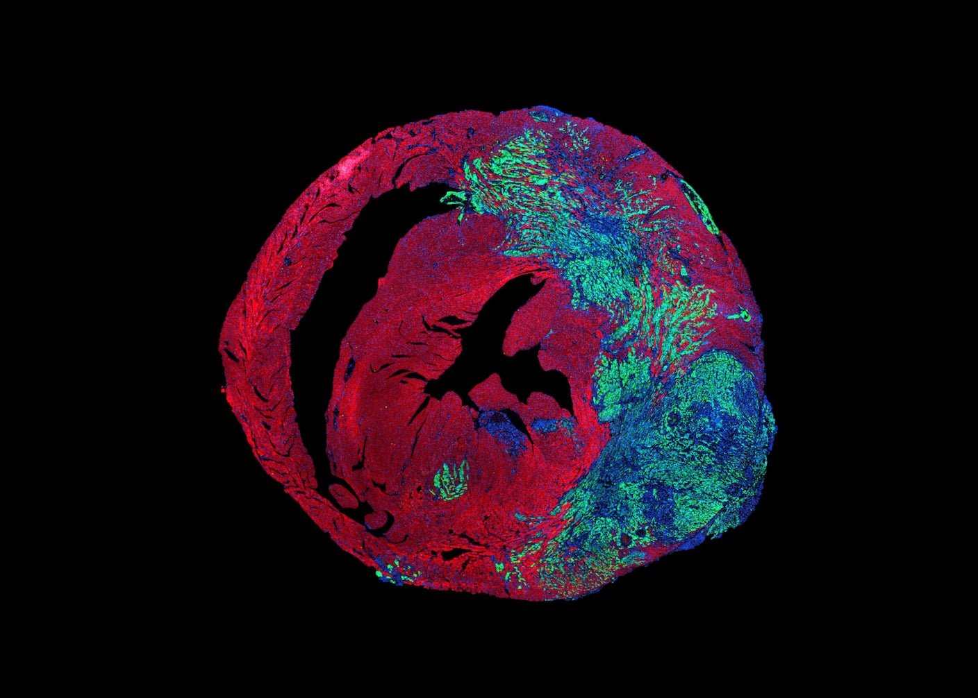 The Heart Rarely Gets Cancer. Scientists Think They Know Why.
