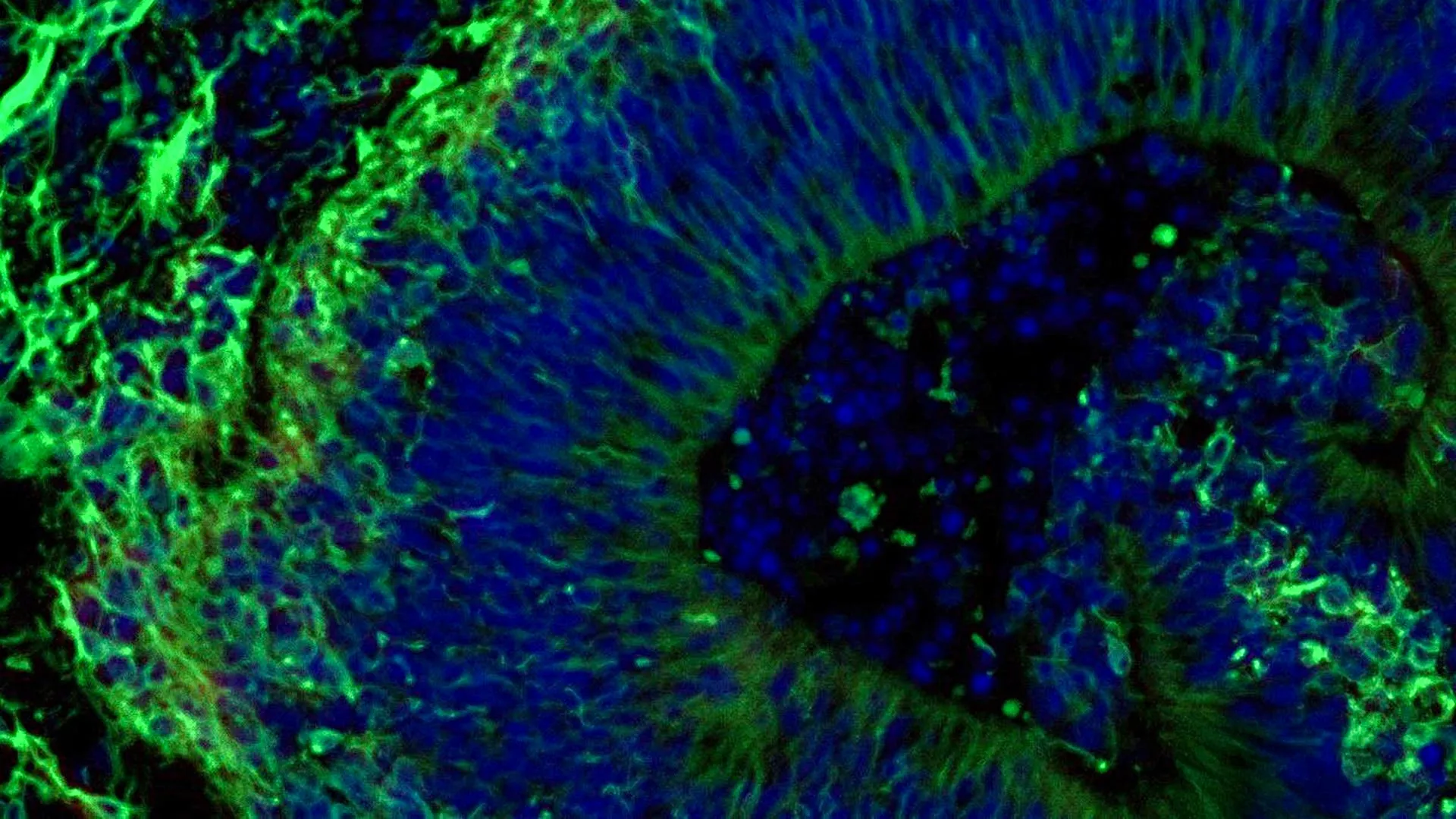 Lab-grown mini brains may predict which Alzheimer’s treatments will work