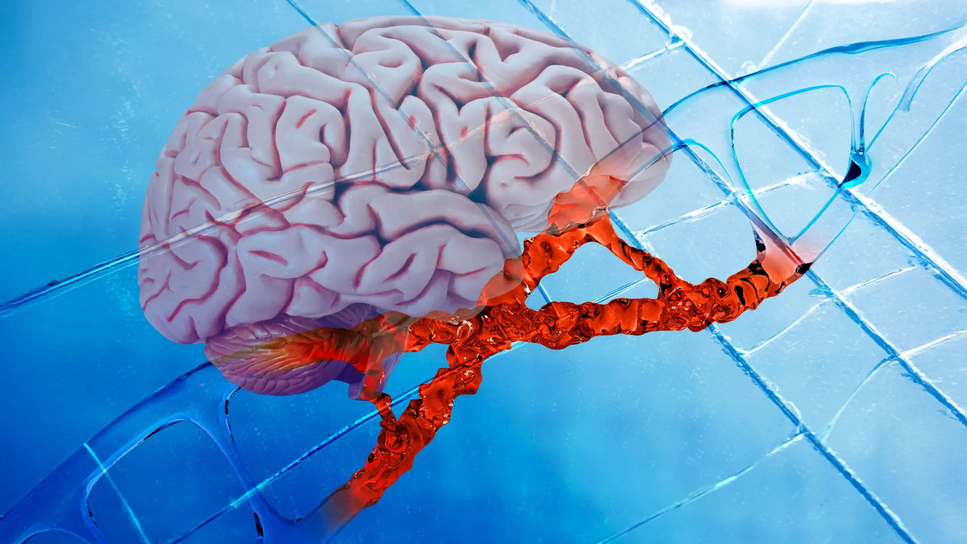 New Alzheimer's drug repairs DNA damage and reduces brain inflammation