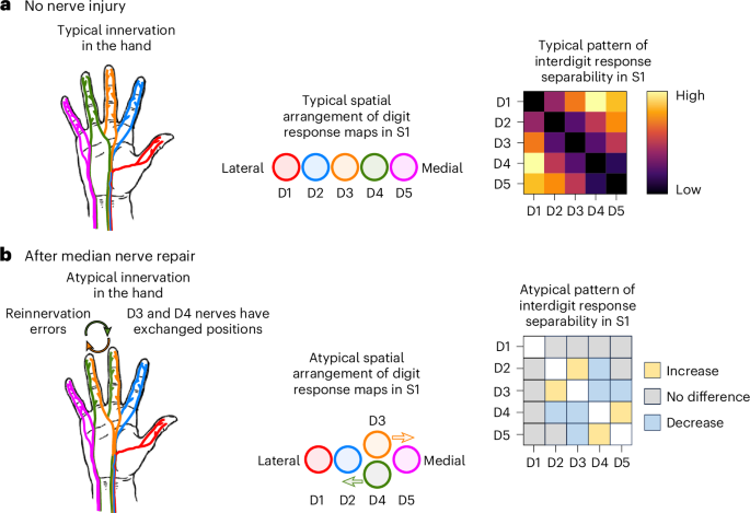 Cutting a nerve of the hand alters the organization of digit maps in primary somatosensory cortex