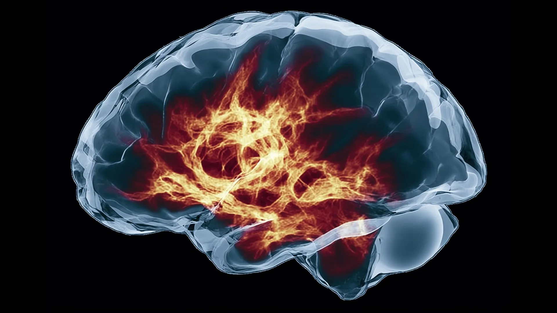 After 30 years, scientists finally have a drug for a deadly brain disease