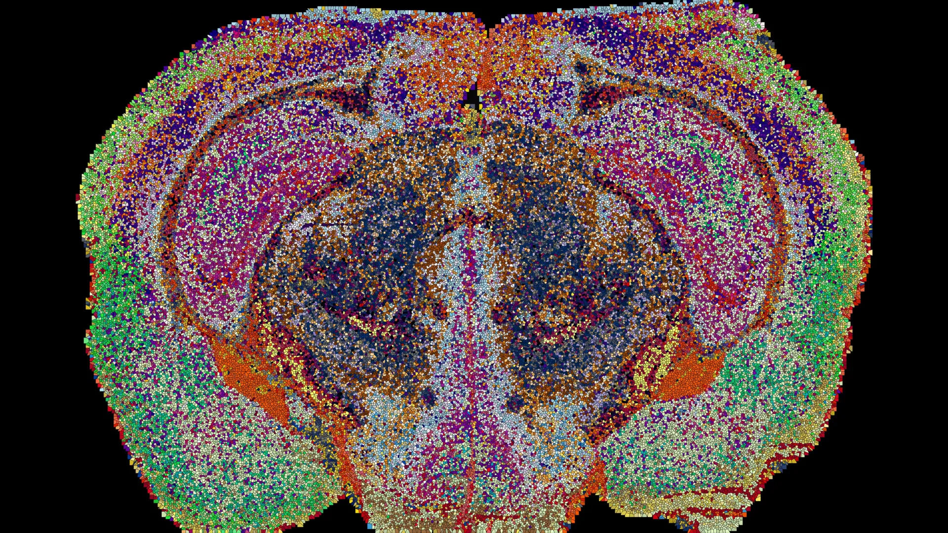 Scientists uncover a hidden map of the brain with 539 distinct regions